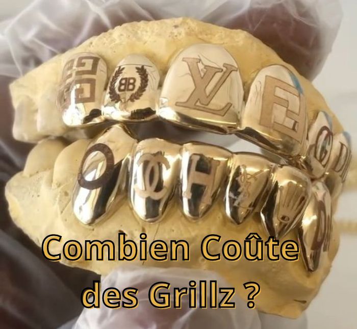 Combien coûte des grillz ?